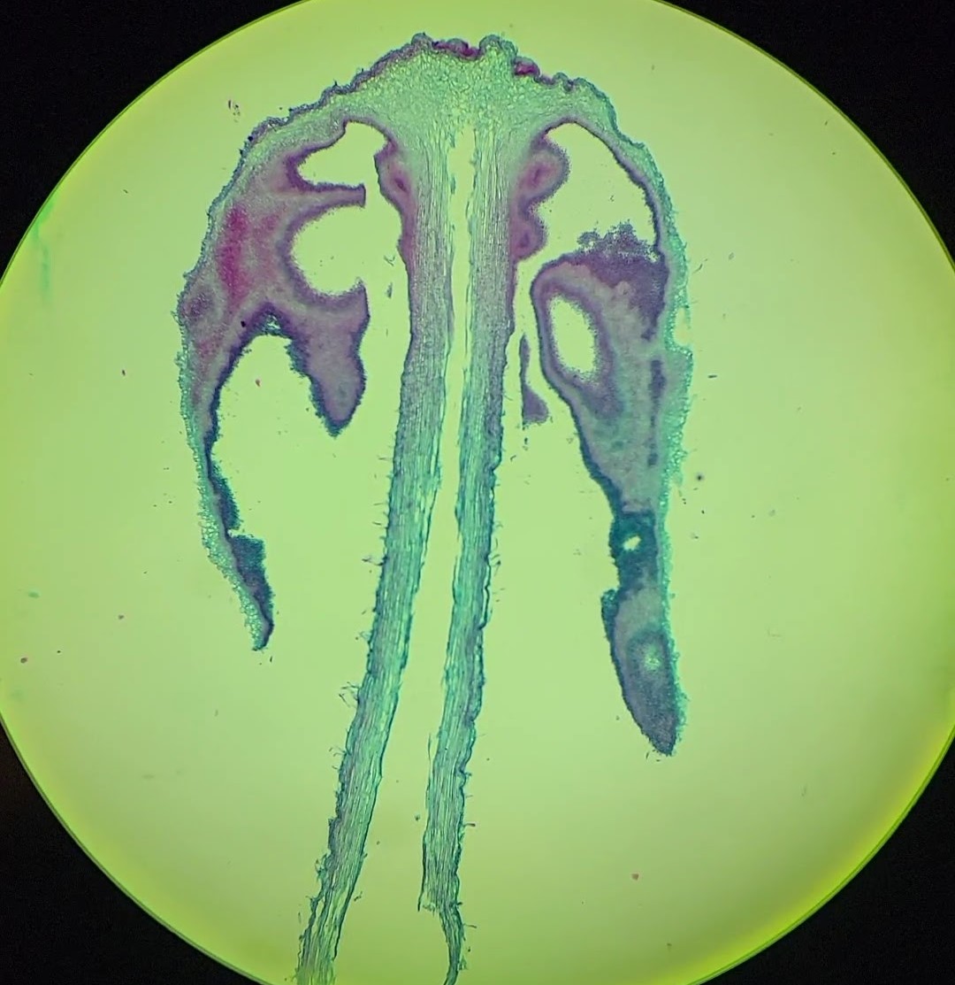 fungus under microscope